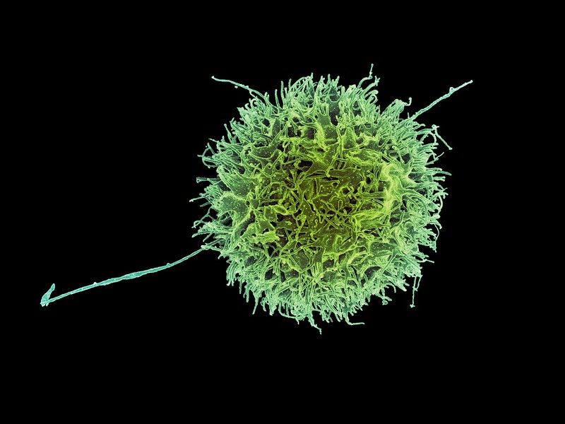 Artiva’s IPO Secures $167M for Advancing NK Cell Therapy in Autoimmune Disease Treatment