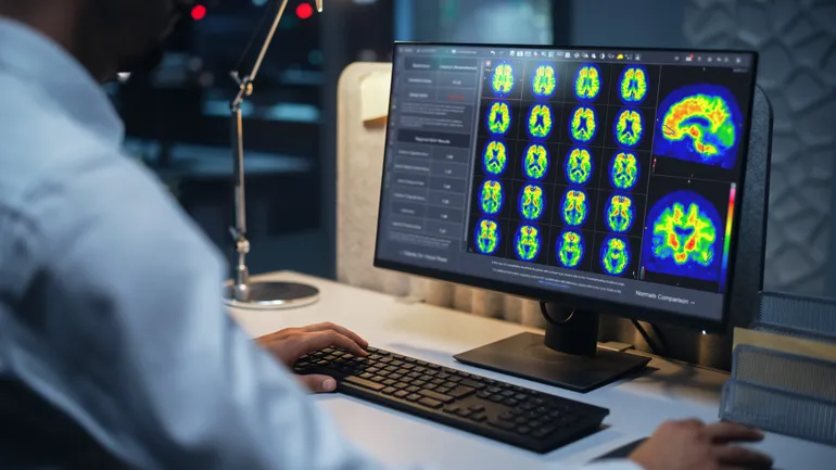 FDA Grants GE Healthcare Approval for Alzheimer’s Imaging Software